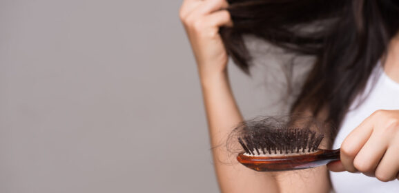 Nadmierna utrata włosów – jak sobie z nią radzić?